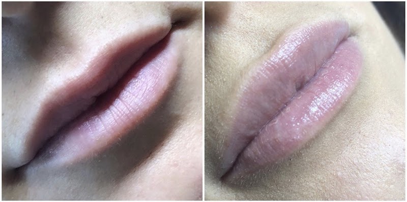 Wylie Skin Spa, LLC, spa in Wylie, TX, photo 4 of 10